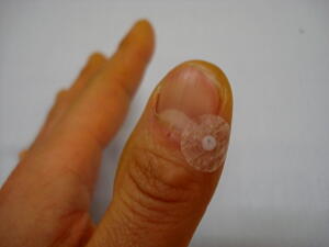 井穴（H1)にパイオネックス