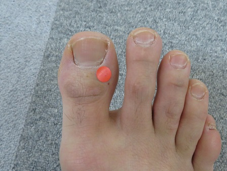 肝臓の井穴右F2