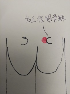 右上後腸骨棘の痛み図