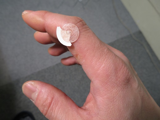 経筋治療　圧痛点にパイオネックスイエロー