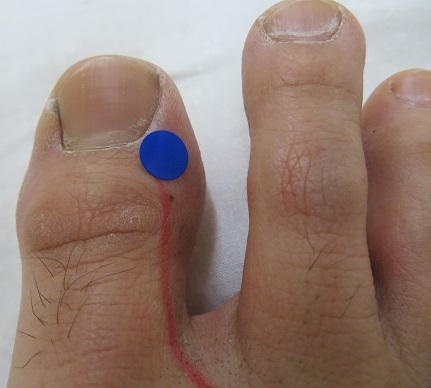 経絡の流れ　足の肝経例