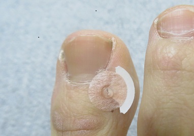 井穴に貼るとき最初はシールを残すの画像