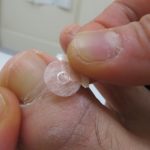 井穴にパイオネックス