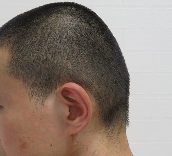 電動バリカンPanasonic ER 5204Pの6ミリのアタッチメントによるカット画像