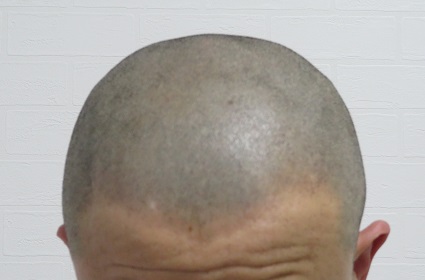 電動バリカンPanasonic ER 5204Pのアタッチメント無しでのカットの画像