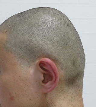 電動バリカンPanasonic ER 5204Pのアタッチメント無しでのカットの画像