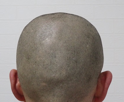 電動バリカンPanasonic ER 5204Pのアタッチメント無しでのカットの画像