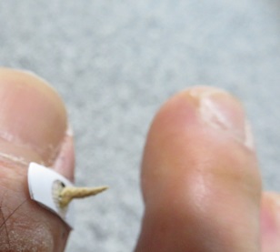 井穴に灸点紙灸の画像