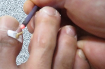 井穴に灸点紙灸の画像