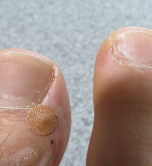 井穴にマグレイン