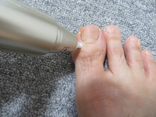 電子温灸器バンシンプロを井穴（右F1)に当てている画像