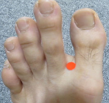 ワキガのツボ　行間（こうかん）の画像